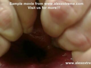 Alexextreme - anal com o punho, espéculo, prolapso, extremo dildo